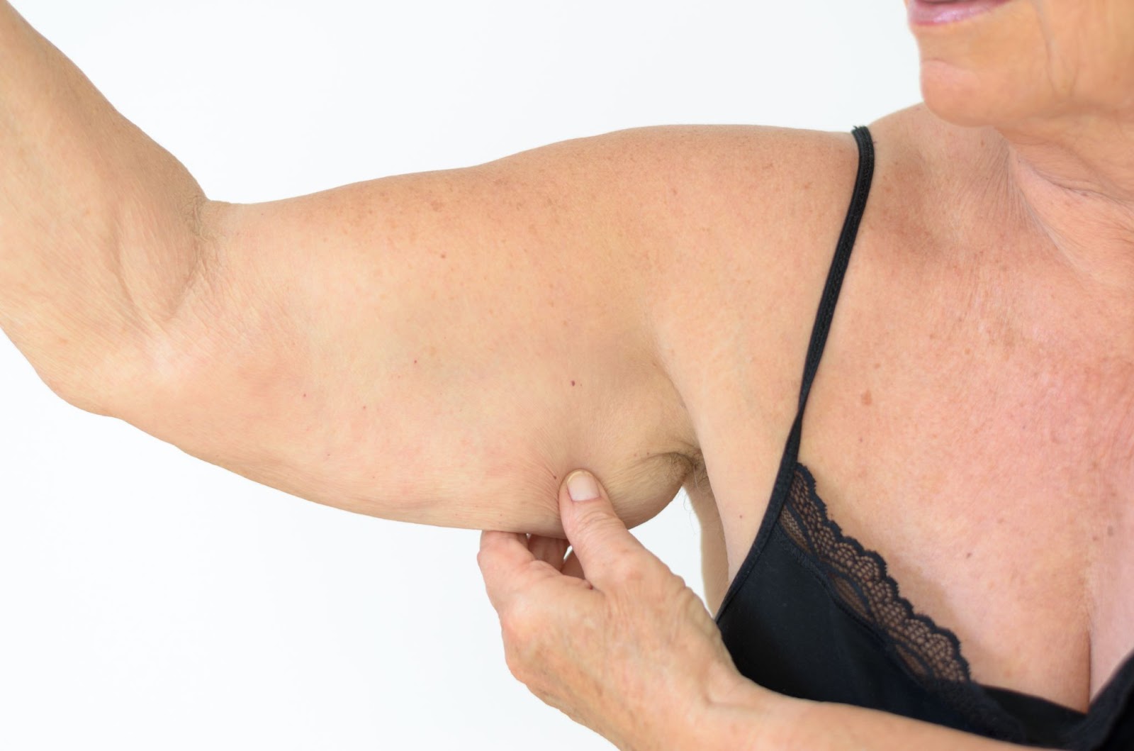Here's How to Get Rid of Flabby Arms & Bat Wings For Good